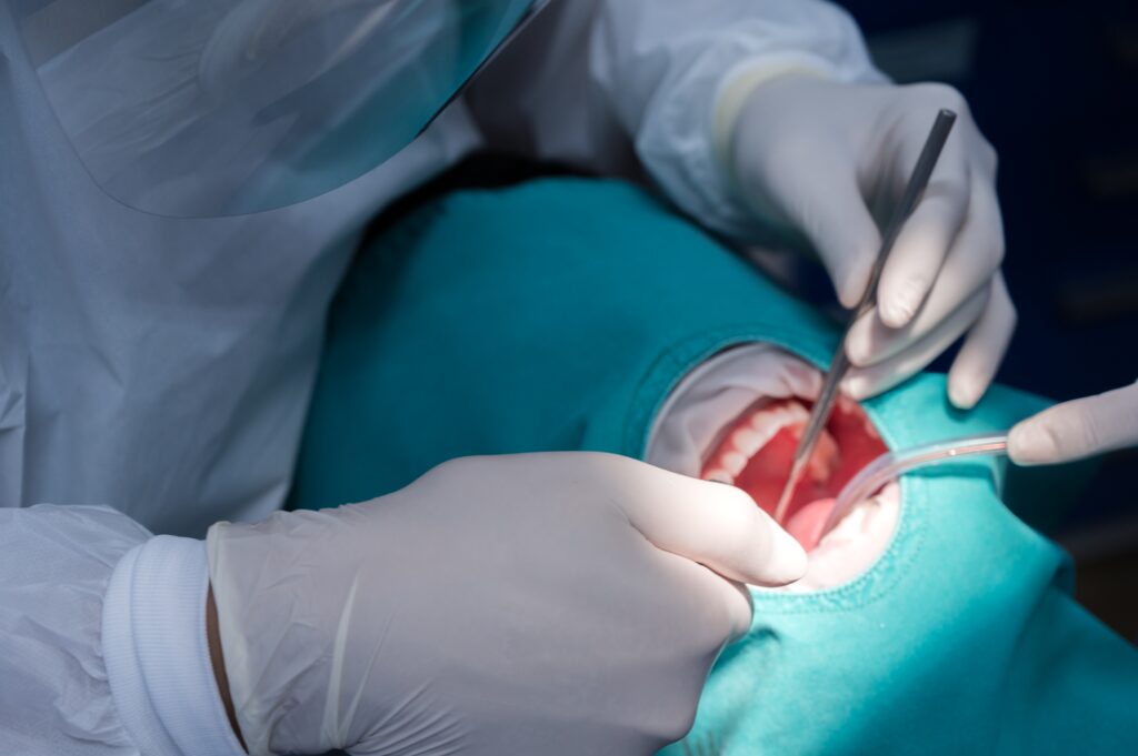 Dental Implants Post-Op Instructions